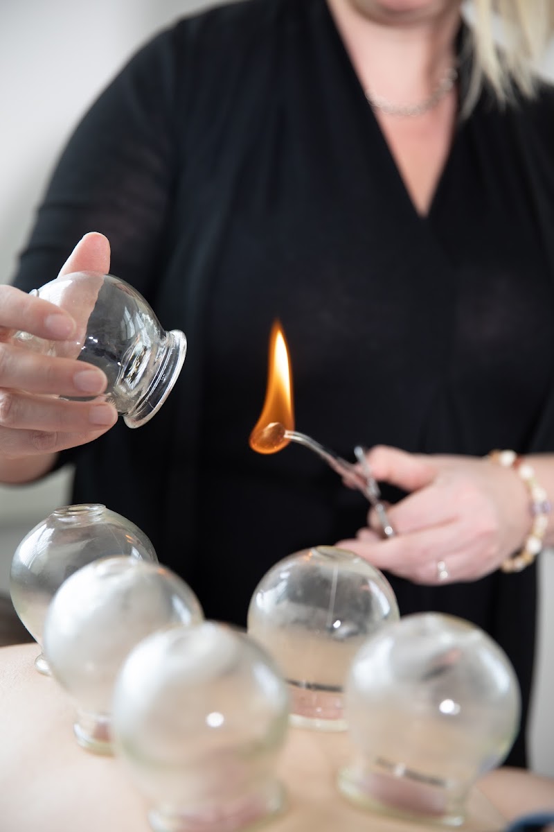 Fitchburg Acupuncture