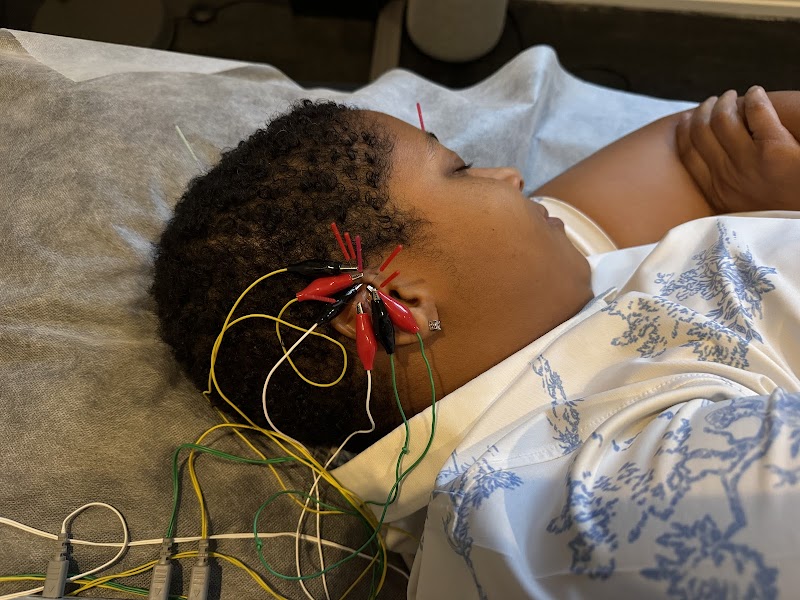 EVOLVE Acupuncture & Wellness