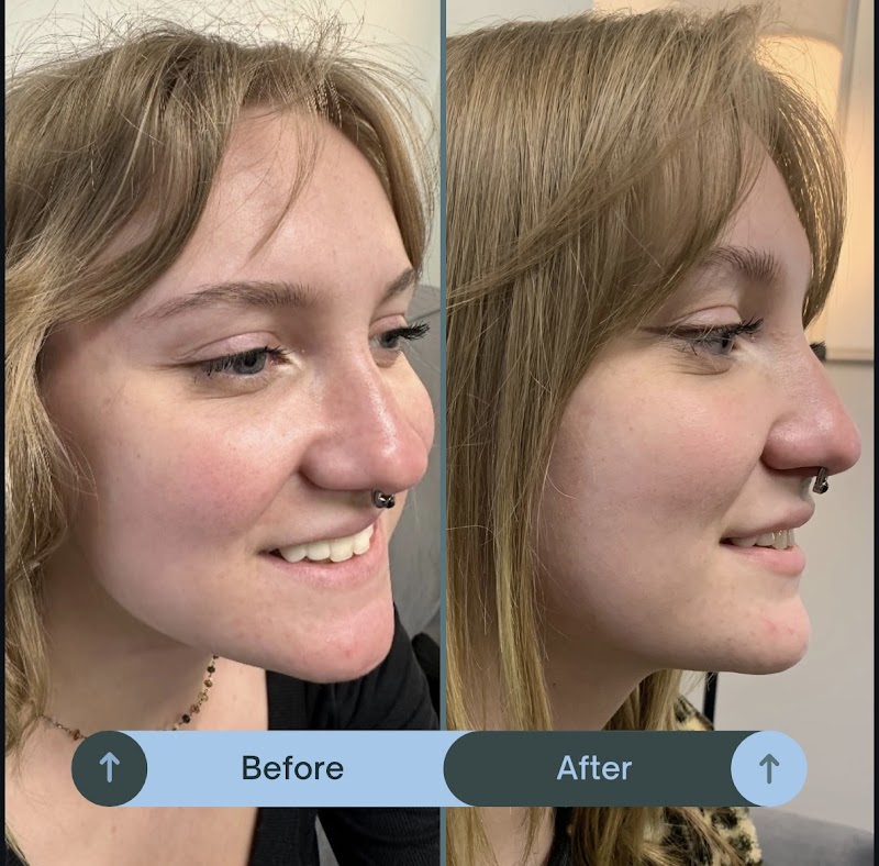 DeepHaven Rejuvenation